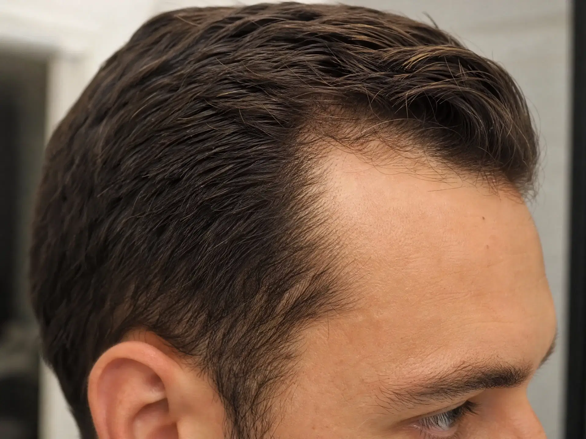 Healthy foods supporting hair health